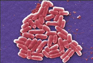 Superbugs are a global threat, medical experts warn