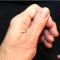 How To Cope With Dry, Cracked Hands